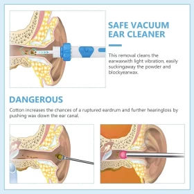 Electric Earwax Remover